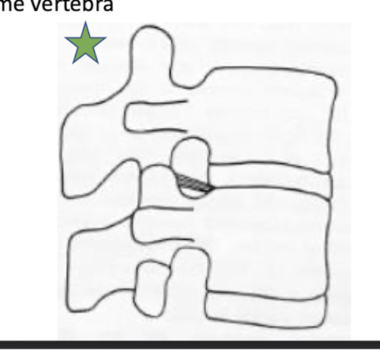 <p>Inferior transforaminal ligament</p>