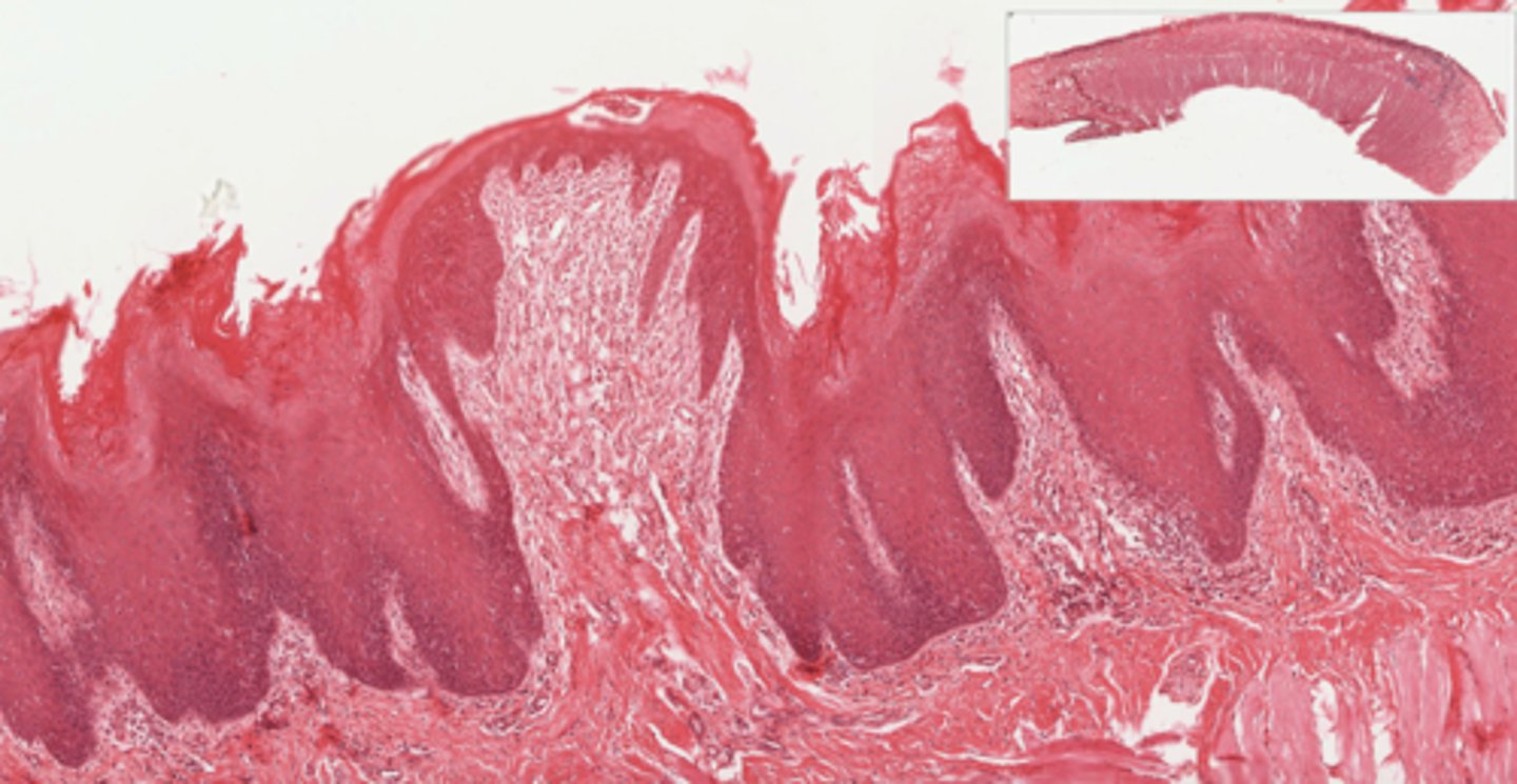 <p><em>identify the papillae:</em></p>