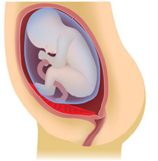 <p>What kind of placenta is shown?</p>