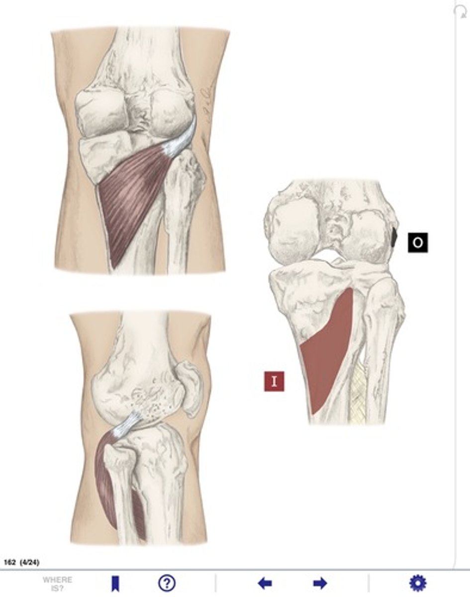 <p>Name the ligament in the image</p>
