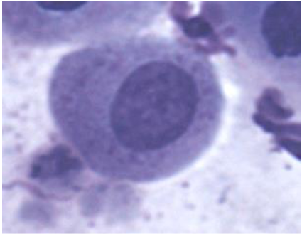 <p><span style="color: rgb(0, 0, 0);"><span>Den minsta epitelcelltypen<br>Rundade kanter stor kvot kärna/cytoplasma,<br>Granulerad kärna</span></span></p>