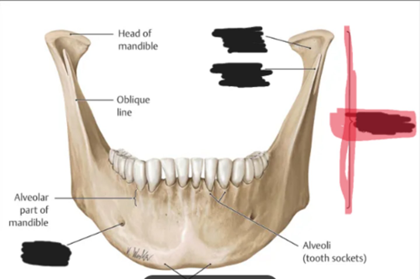<p>Ramus of the mandible</p>