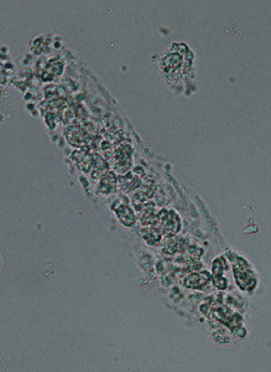 <p>consist of a uromodulin mucoprotein matrix containing RBCs, WBCs, renal tubular epithelial cells, or a mixture of these cell types. Originate from the distal tubules. The presence of ______casts is always abnormal.</p>