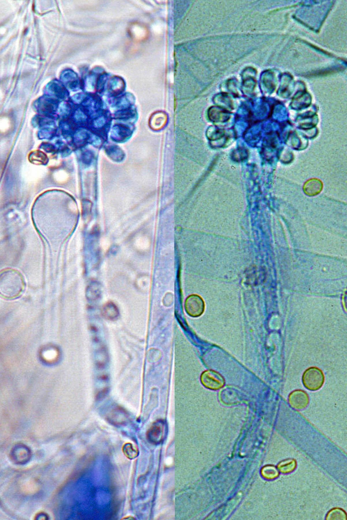 <p>Identify this fungus</p>