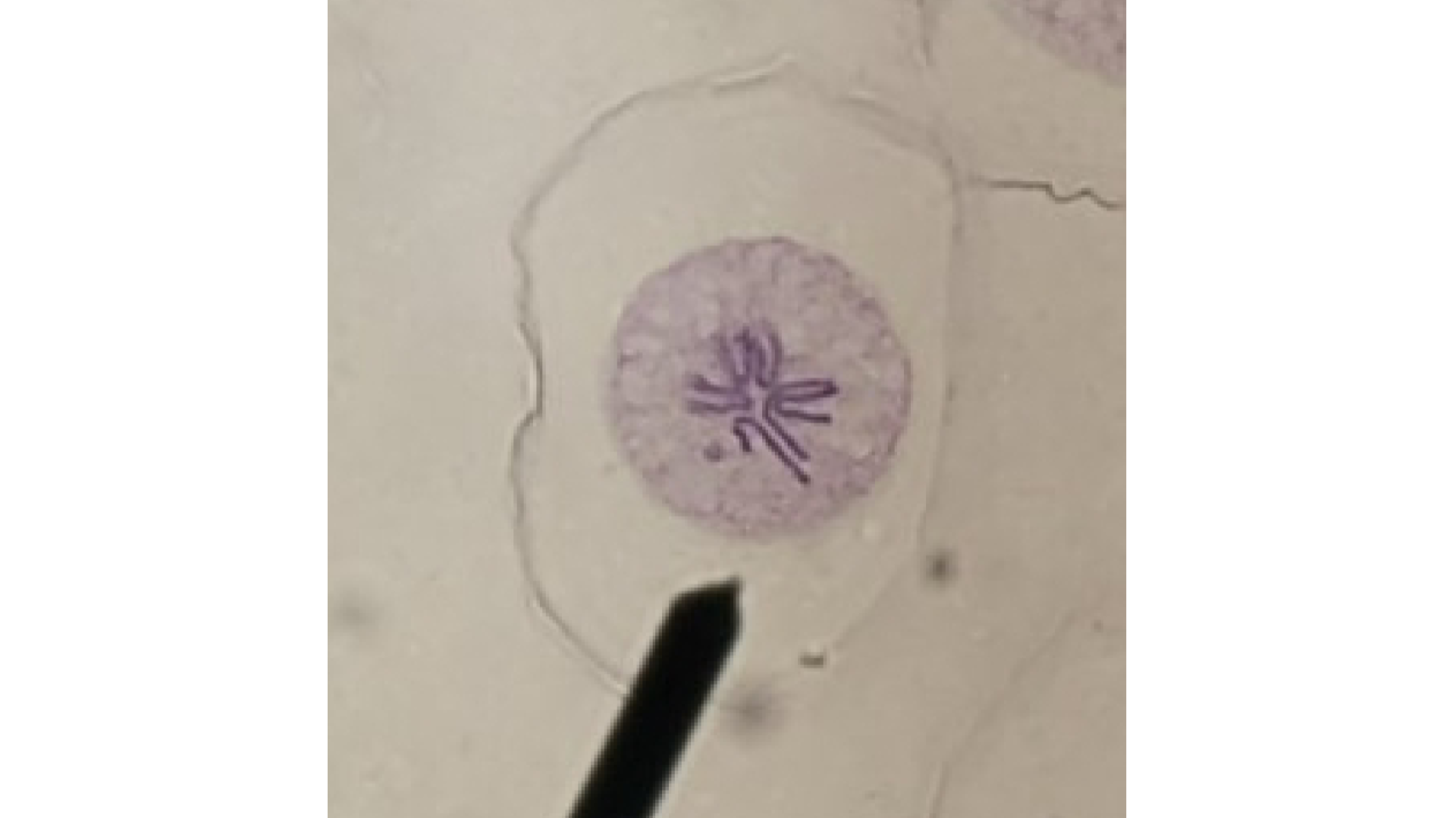 <p>What stage is the cell in?</p>