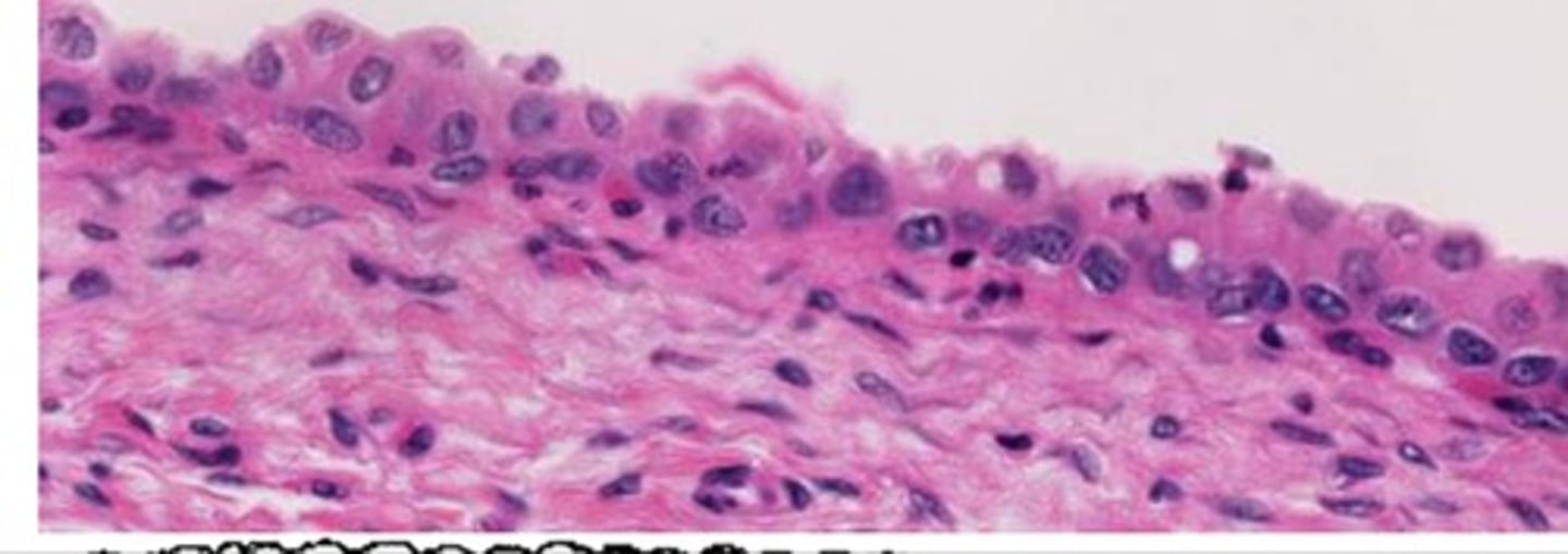 <p>multiple layers; apical cells are rounded but can look more flattened when stretched. Apical cells are larger than basal cells.</p><p>Typical location: Urinary System</p>