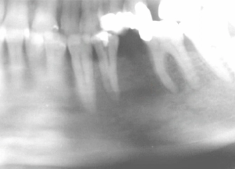 <p>how would you describe the border of this lesion </p>