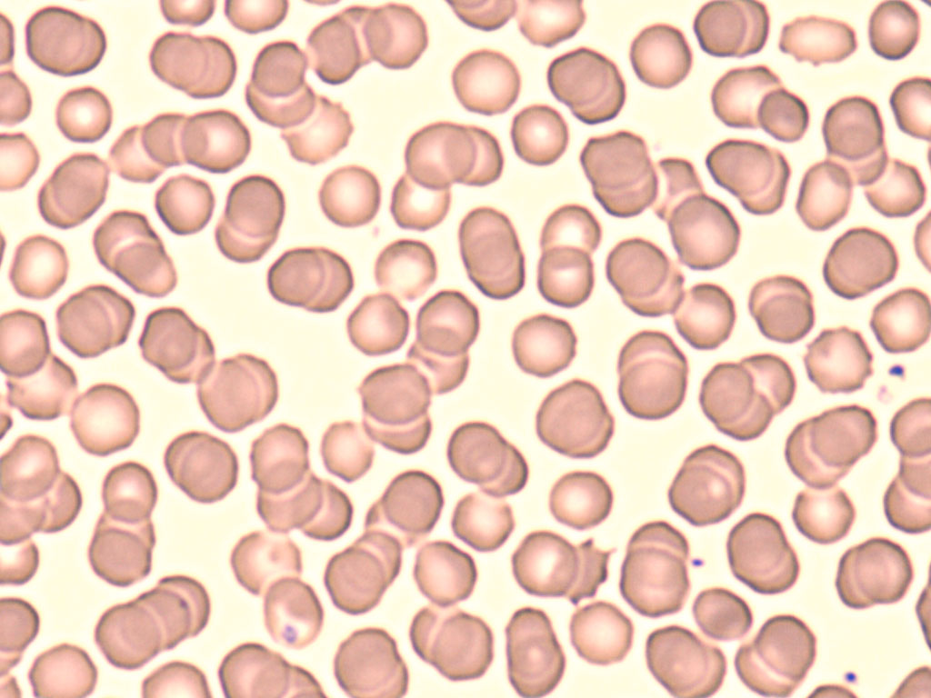 <p>Erythrocyte</p>