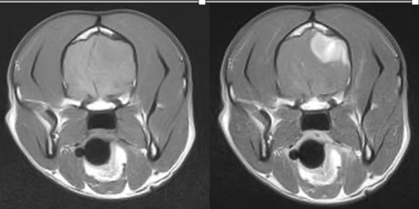 <p>which MRI is pre and post contrast?</p>