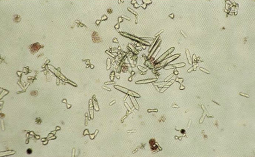 <p>What crystals are these?</p><p>What is the name of the chemical/poison associated with this crystal and where is it found?</p><p>Are they found in alkaline or acidic urine?</p>