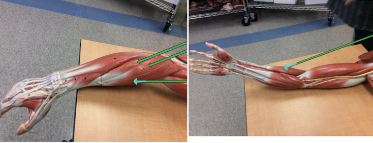 <p>Identify this muscle?</p>