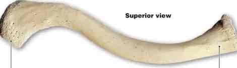 <p>What kind of bone is this?</p>