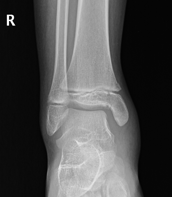 <p>Describe the abnormality demonstrated.</p>