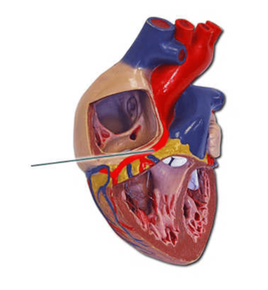 <p>right coronary artery</p>