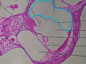 This structure is FILLED with