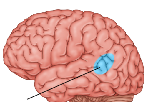 term image