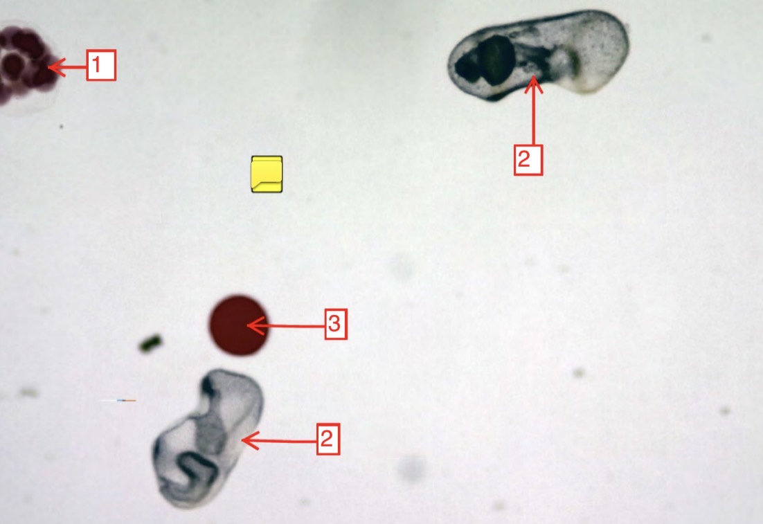 <p>starfish development stages- (3)</p>