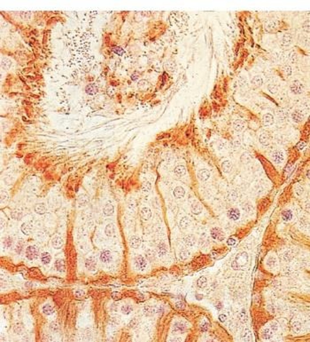 <p>It is a golf-ball sized gland that encircles the urethra and is comprised of smooth muscle and connective tissue.</p>