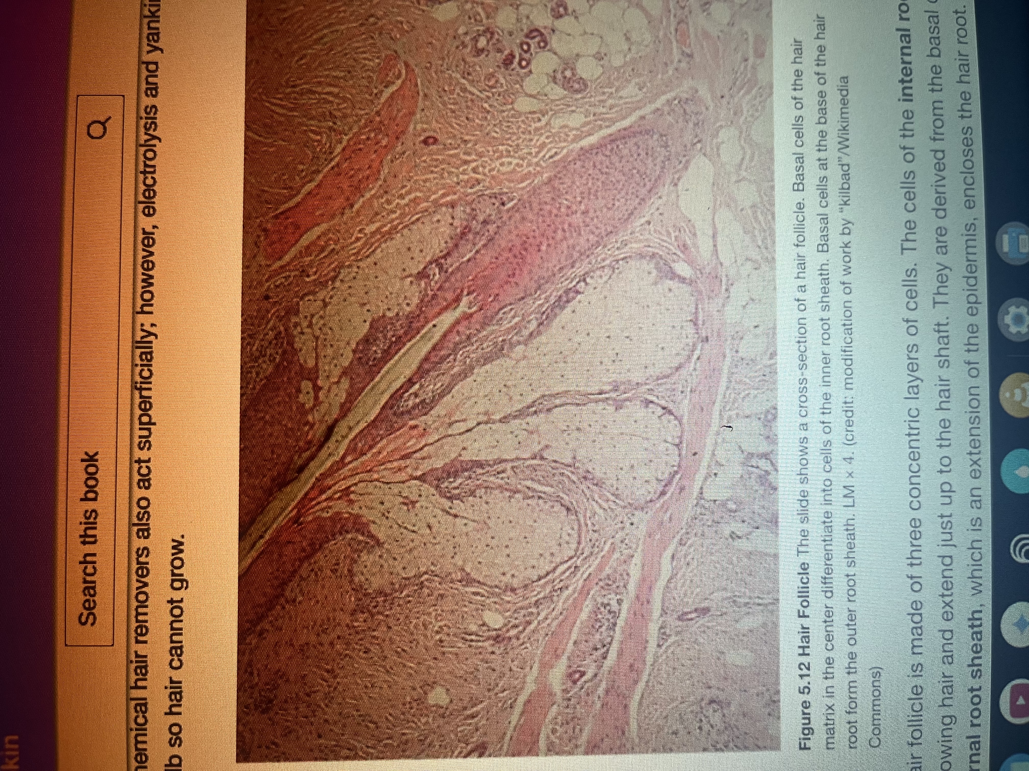 <p>Structure within the skin that surrounds the hair root and from which hair grows.</p>