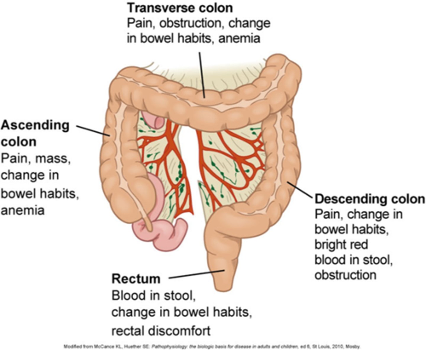 <p>- Insidious onset: symptoms often do not appear until disease is in advanced stages</p>