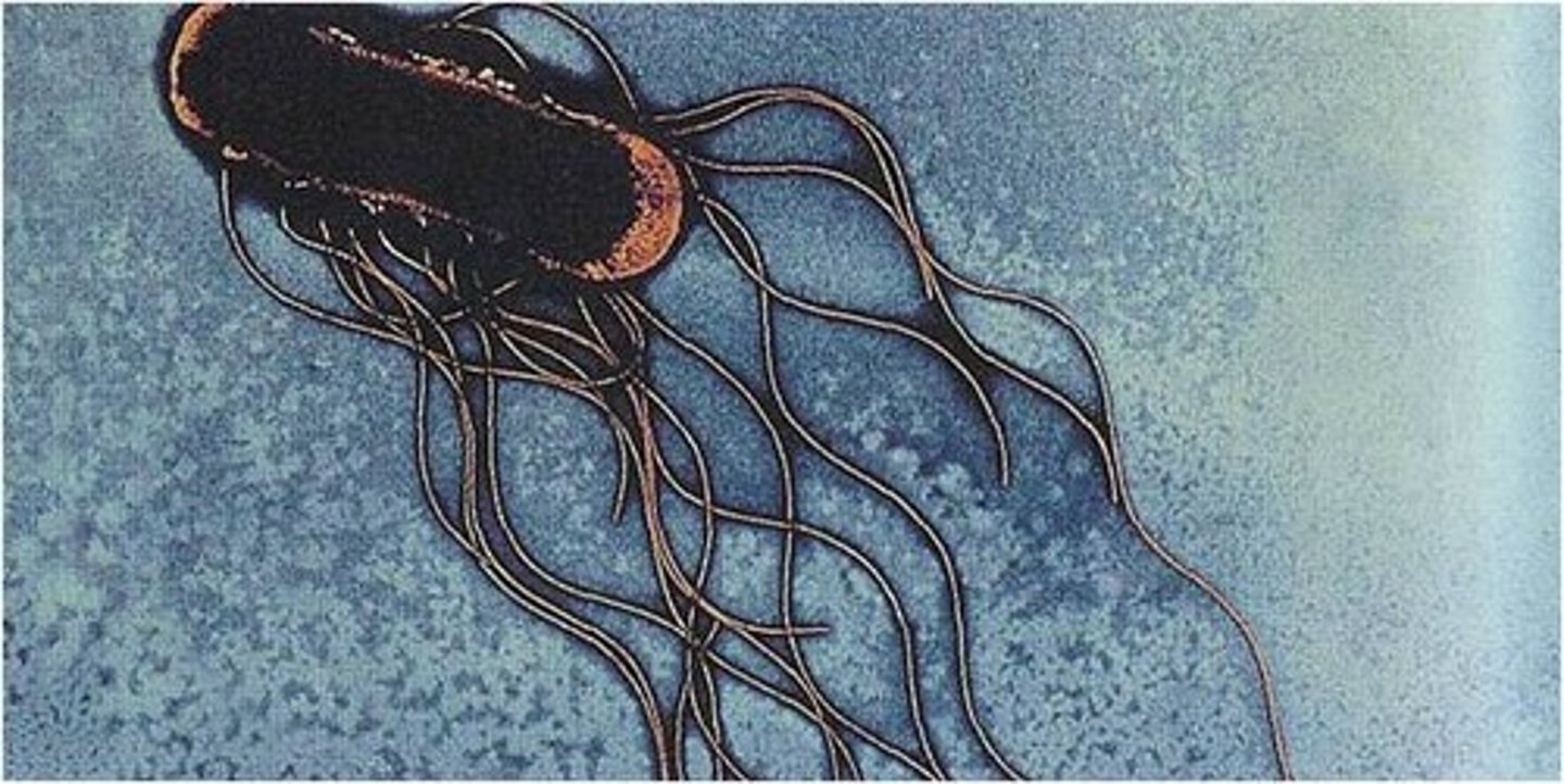 <p>flagella surrounding the entire outside of bacteria</p>