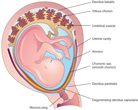 <ul><li><p class=""><strong>Villous chorion</strong> or “<strong>bushy chorion”:</strong> area with chorionic villi; becomes the <strong>placenta</strong>.</p></li><li><p class=""><strong>Smooth chorion:</strong> part where villi degenerate. It degenerates because <strong>the areas of the chorion not in contact with the decidua basalis receive poor vascular support,</strong> leading to villous atrophy and the formation of the smooth chorion</p></li></ul><p></p>