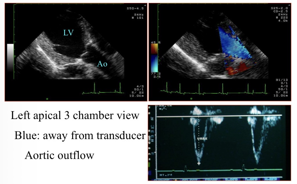 <p>Why is the blood blue when moving LV → aorta </p>