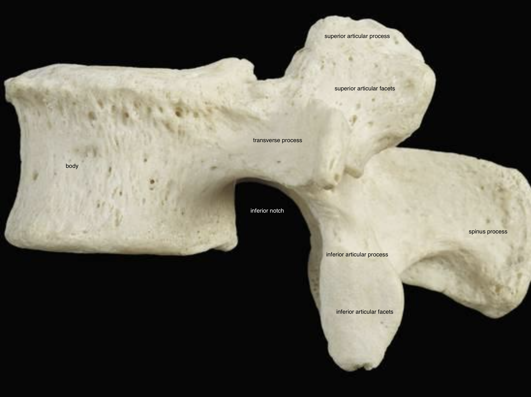 <p>Lumbar vertebrae</p>