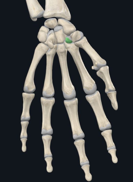 <p>What bone is this</p>
