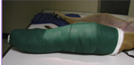 <p><span style="background-color: transparent;"><strong>Robert Jones Bandage</strong></span></p>