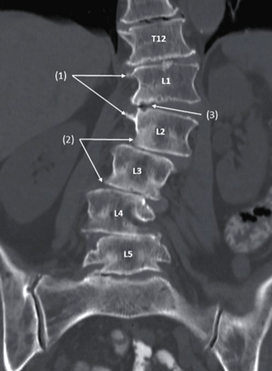 <p>what type of imaging is this?</p><p>a. T2 MRI</p><p>b. Bone Scan</p><p>c. CT scan</p><p>d. conventional radiography</p>