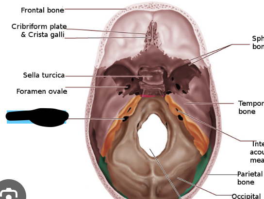 <p>whats crossed one off named (temporal bone)</p>