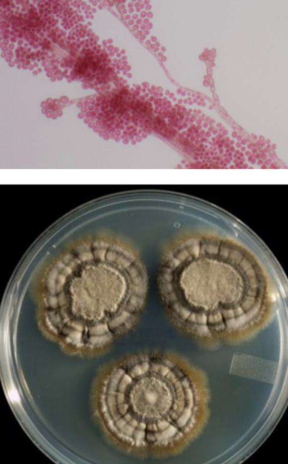 <p>Exophiala dermatitidis</p>