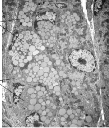<h3 collapsed="false" seolevelmigrated="true">S: Identify this cell. How did you know it was that cell?</h3>