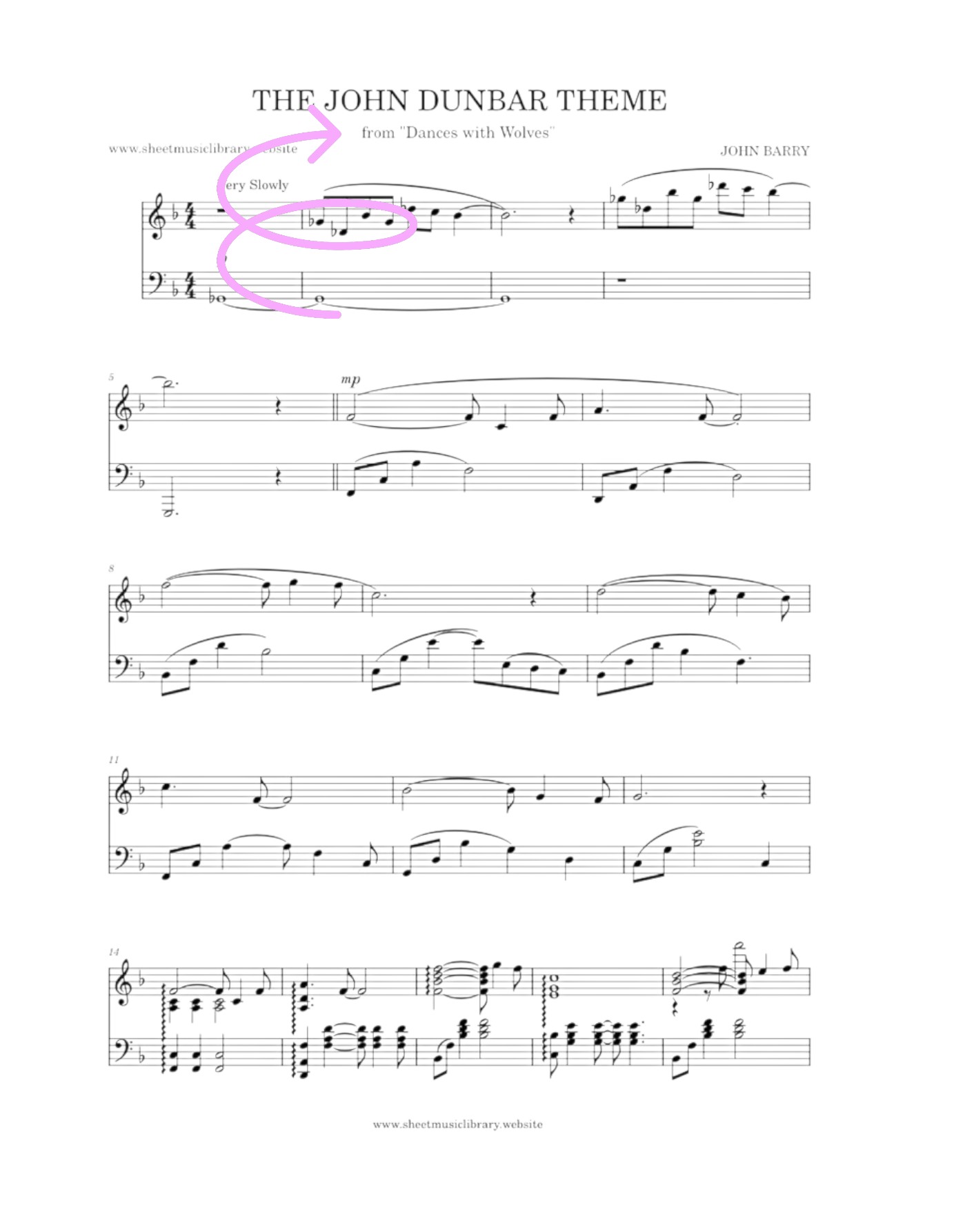 <p>(pink arrow points to?)</p>