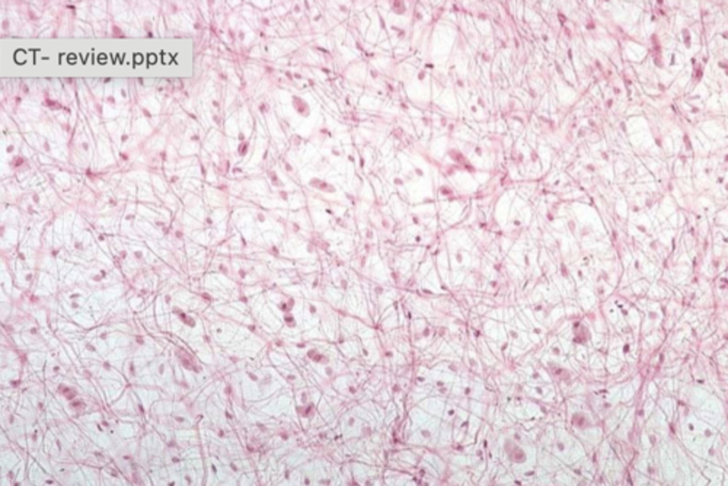 <p>Identify the connective tissue type</p>
