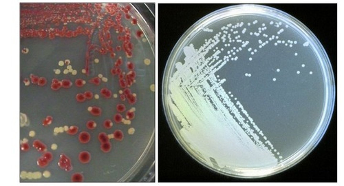 <p>There should uniform looking colonies on the plate (multiple colonies that should look the same)</p>