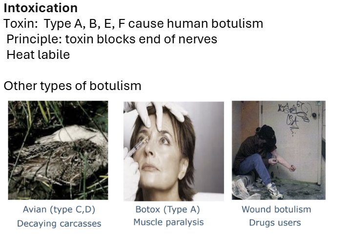 <p><span style="line-height: 16px;">Botulism- Causes botulism through the production of a potent toxin. Lethal neurotoxin. </span></p><p class="Paragraph SCXW114061042 BCX0" style="text-align: left;"><span style="line-height: 16px;"> </span></p><p class="Paragraph SCXW114061042 BCX0" style="text-align: left;"><span style="line-height: 19px;">characteristic of the botulinum toxin :It can be activated in the gut of humans. </span></p><p class="Paragraph SCXW114061042 BCX0" style="text-align: left;"></p>