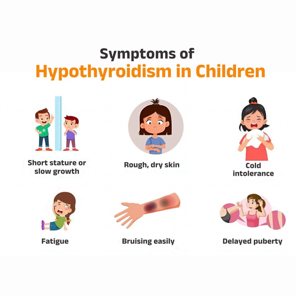 <ol><li><p><span style="background-color: transparent;"><span>Decelerated growth</span></span></p></li><li><p><span style="background-color: transparent;"><span>Myxedematous skin changes</span></span></p><ul><li><p><span style="background-color: transparent;"><span>Dry skin</span></span></p></li><li><p><span style="background-color: transparent;"><span>Sparse hair</span></span></p></li><li><p><span style="background-color: transparent;"><span>Periorbital edema</span></span></p></li></ul></li><li><p><span style="background-color: transparent;"><span>Constipation</span></span></p></li><li><p><span style="background-color: transparent;"><span>Sleepiness</span></span></p></li><li><p><span style="background-color: transparent;"><span>Mental decline</span></span></p></li></ol><p></p><p></p>