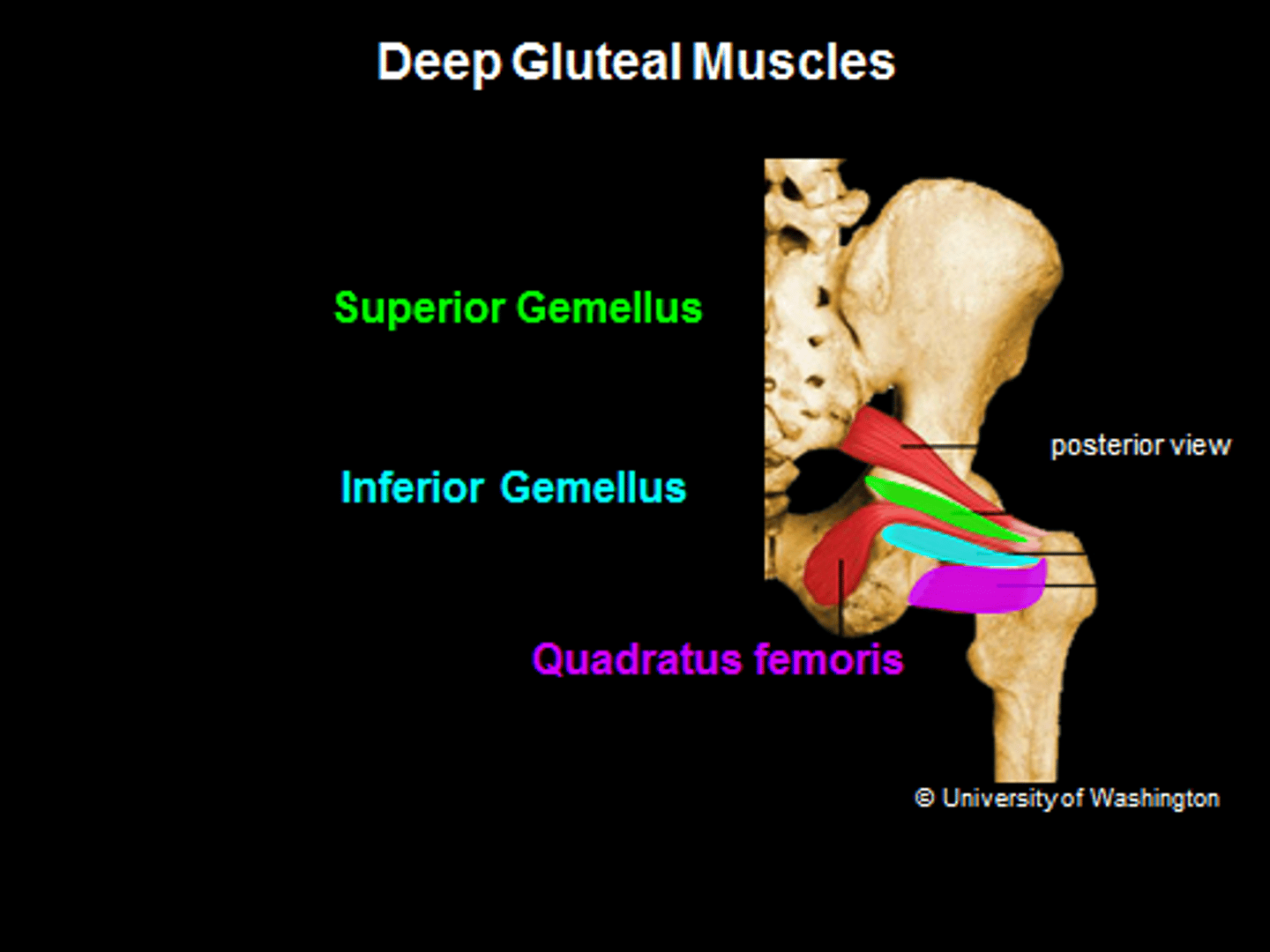 <p>greater trochanter of femur</p>