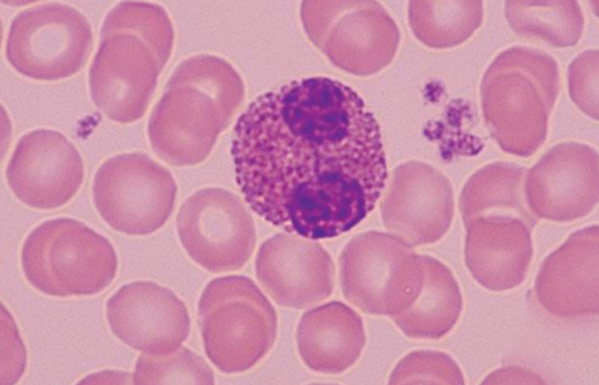 <p>Name the cells SURROUNDING the eosinophil</p>