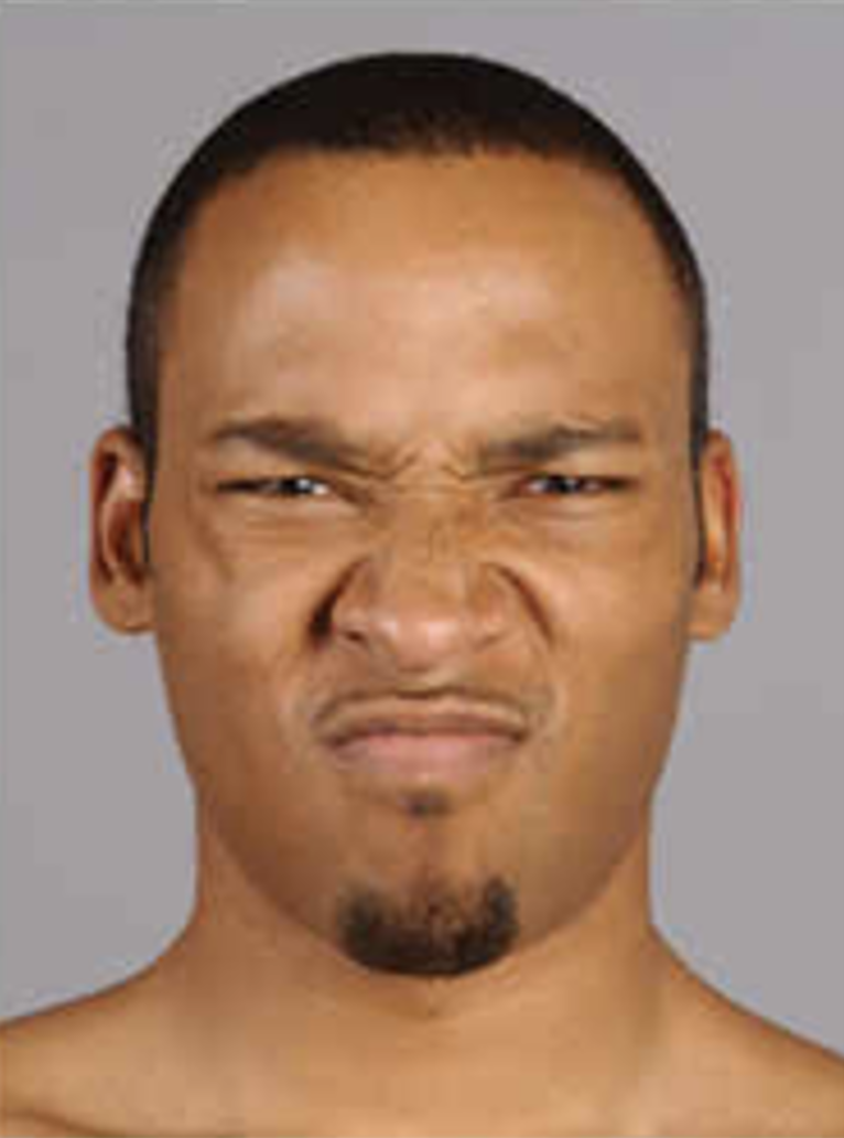 <p>is a muscle of facial expression that pulls the skin between the eyebrows down and helps to create horizontal wrinkles on the bridge of the nose. </p>