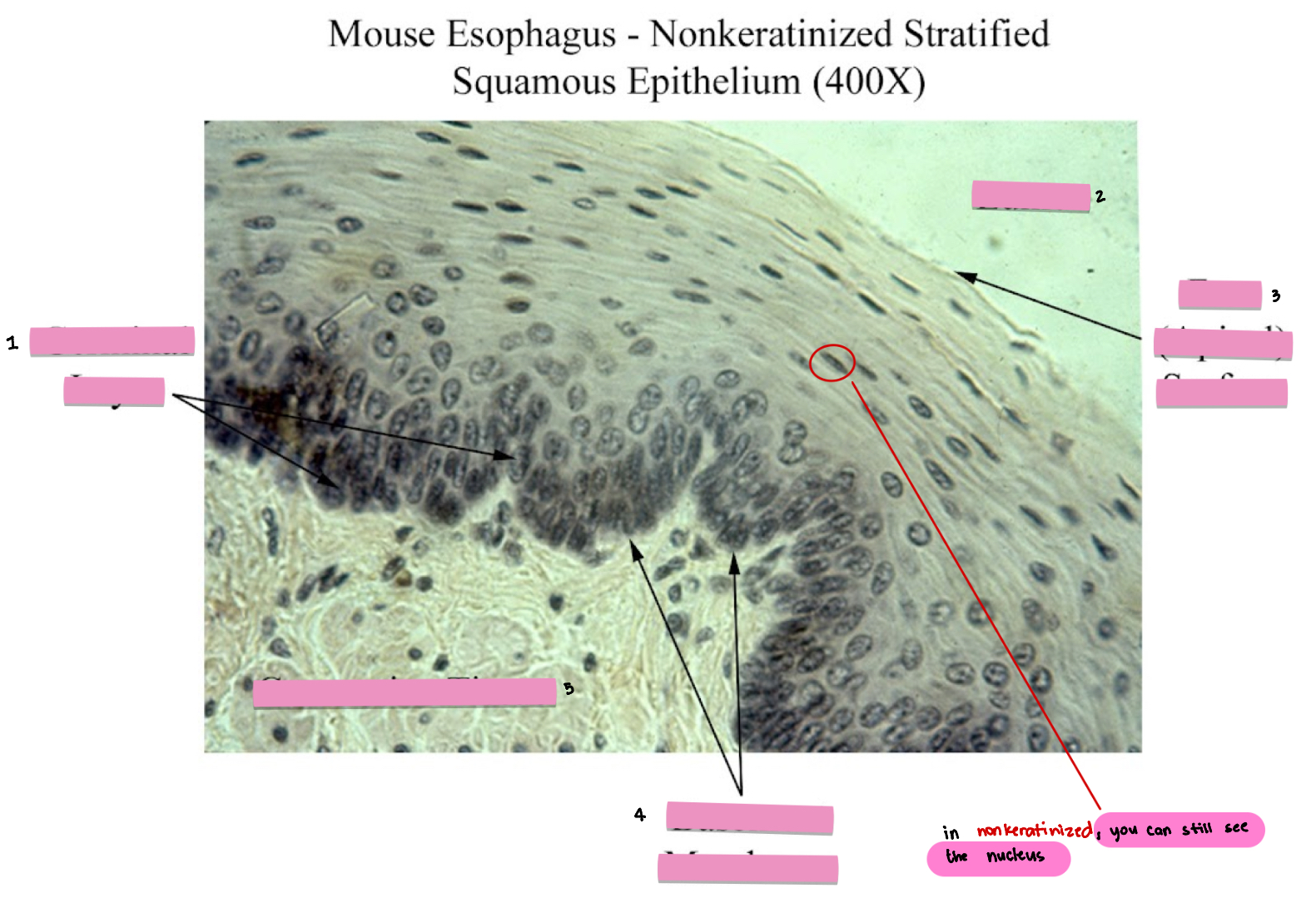 <p>(1) Nonkeratinized Stratified Squamous Epithelium tissue cellular characteristics</p>