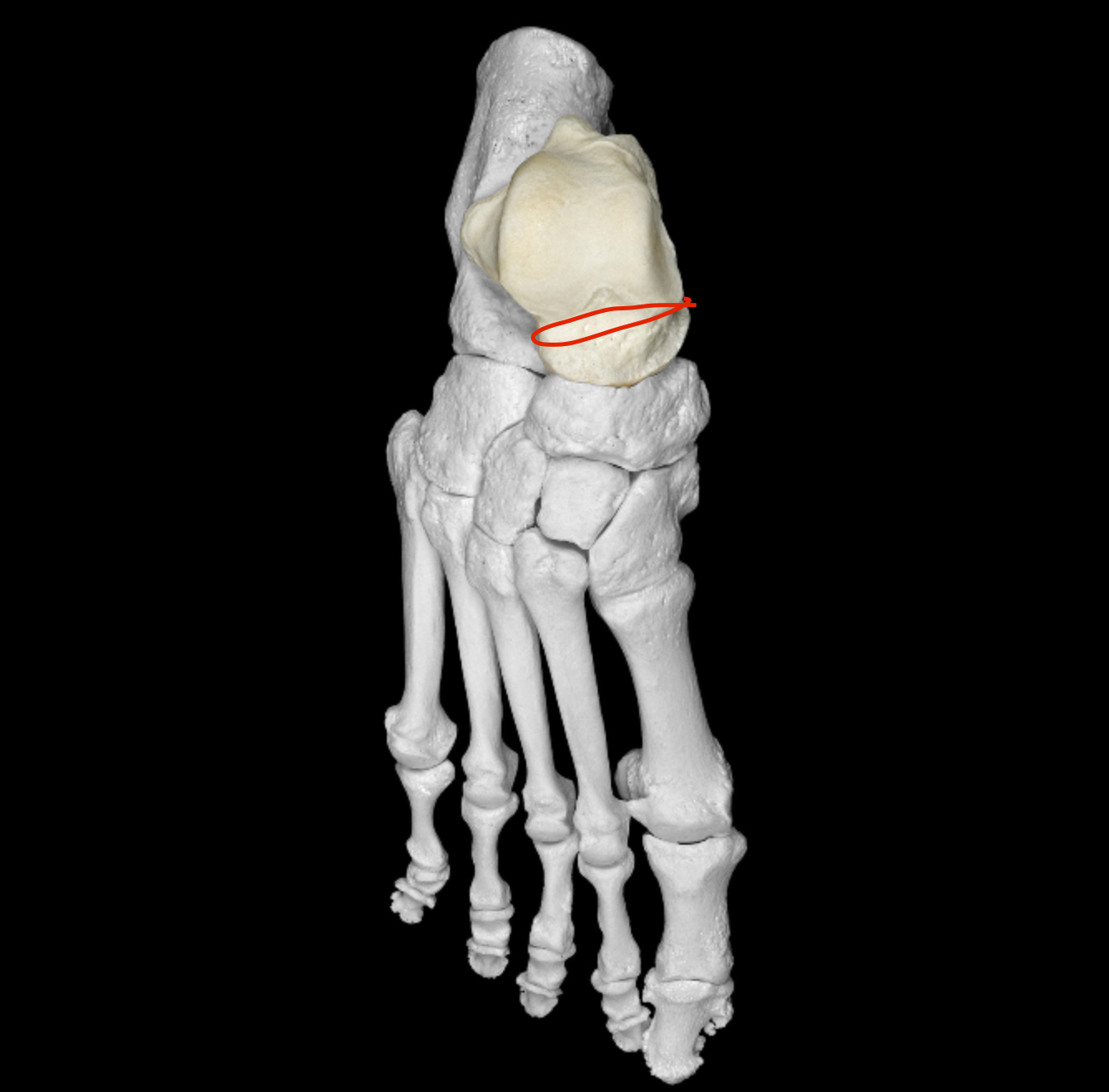 <p>constriction posterior to head of talus </p>