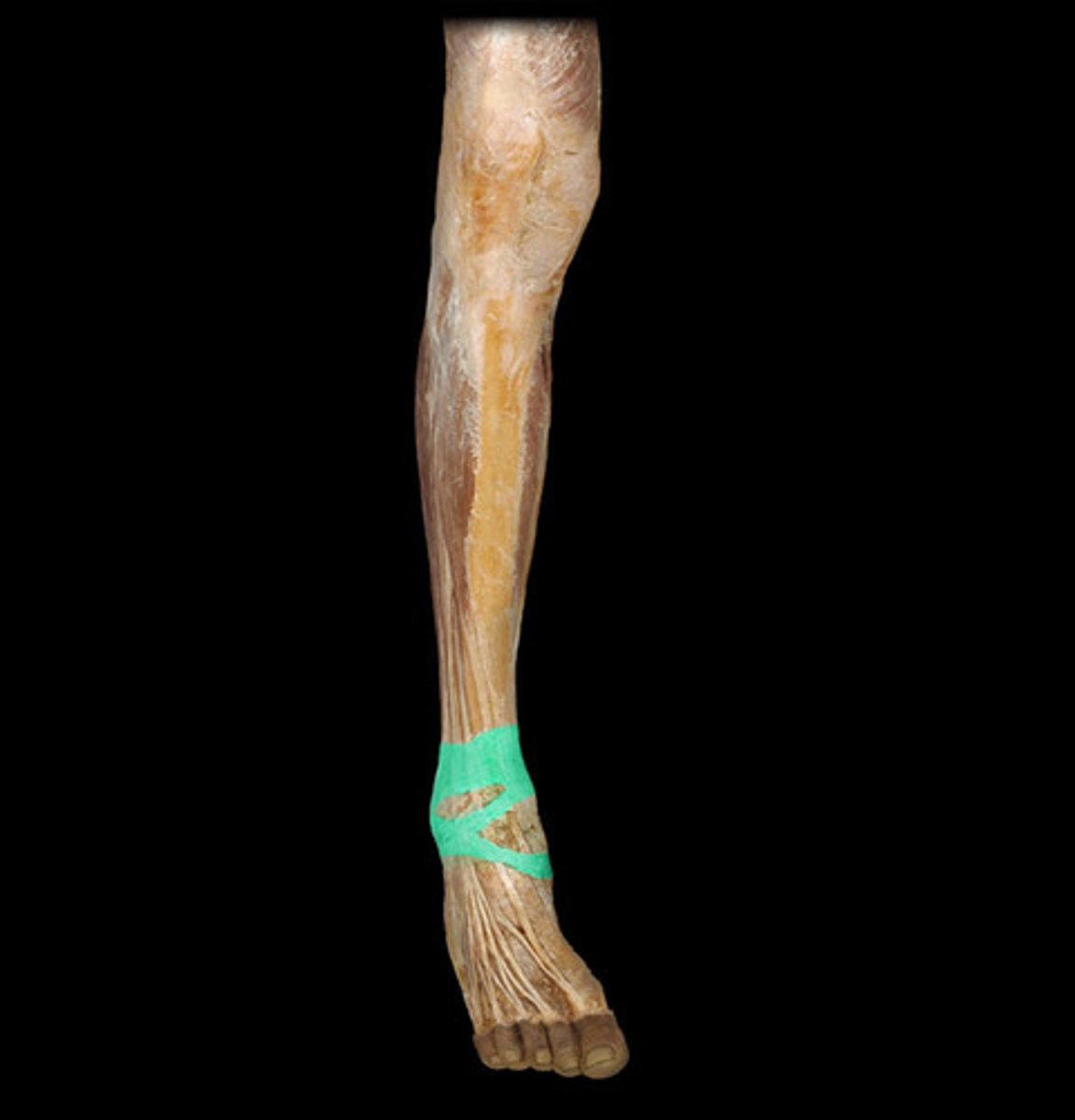 <p>Thickened bands of connective tissue holding ligaments, tendons, and muscles in place</p>