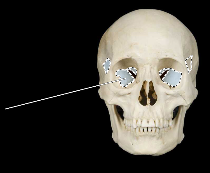 <p>Name this bone.</p><p>(Skull, anterior view).</p>