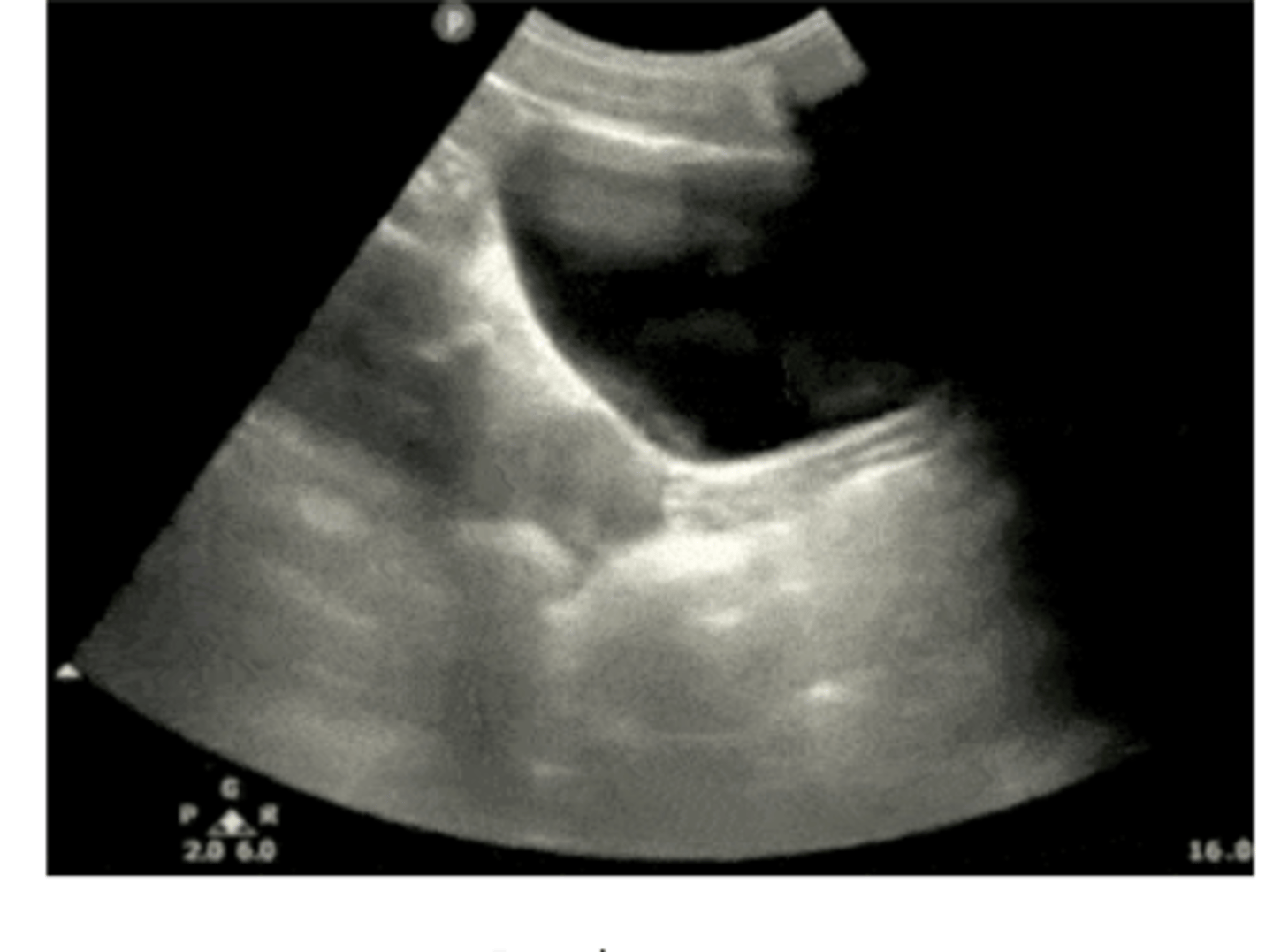 <p>what view is this US of (be specific)</p>