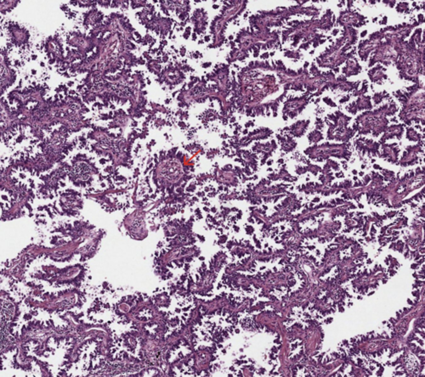 <p>Lung</p>