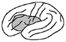 <p>left frontal lobe in the posterior inferior frontal gyrus (left hemisphere)</p>