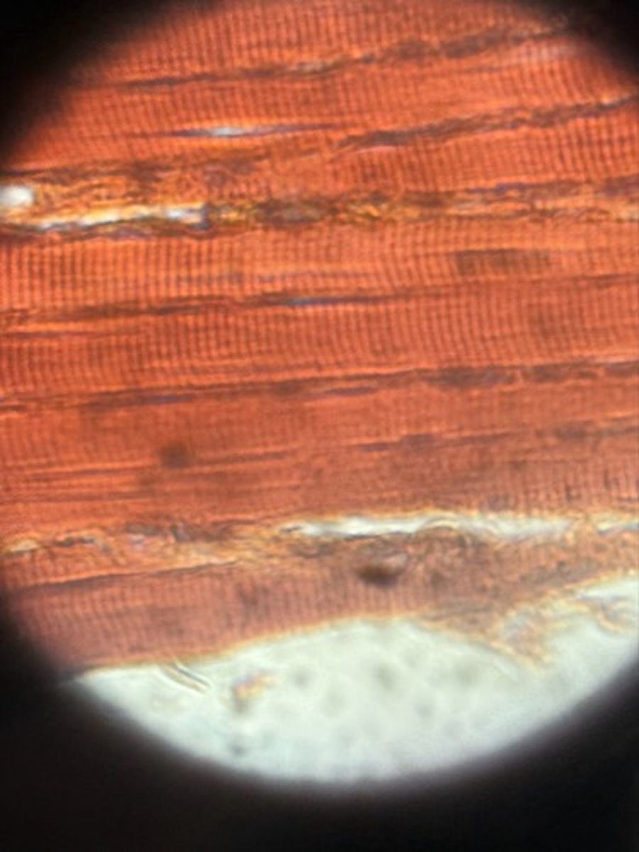 <p>What type of muscle is this?</p>
